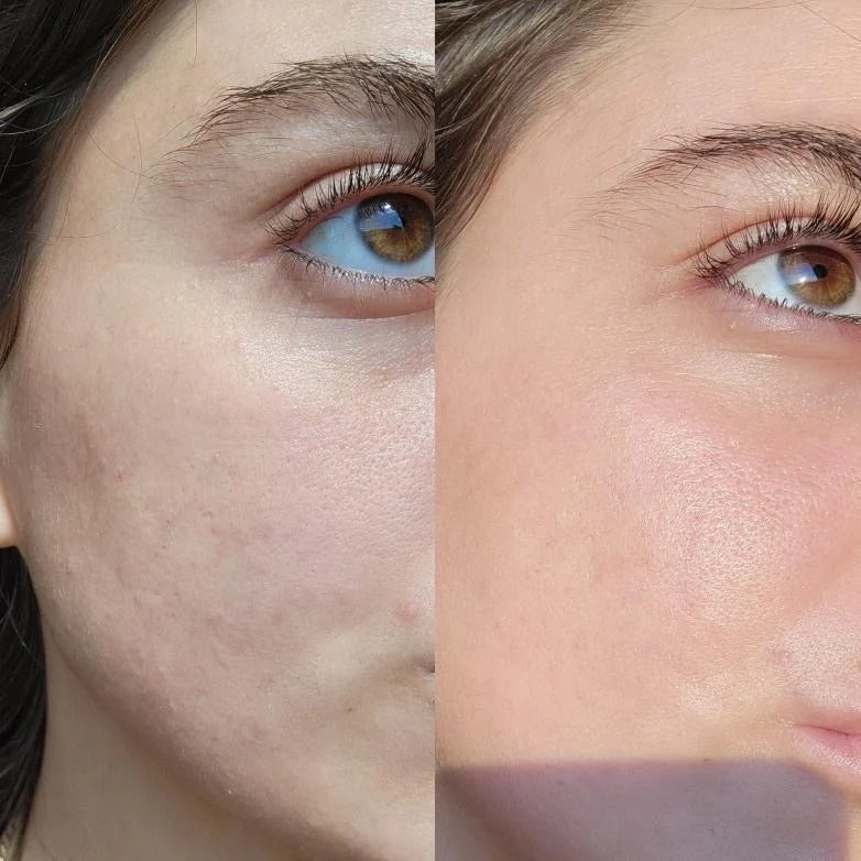 Eco By Sonya Serum of Clear 30ml