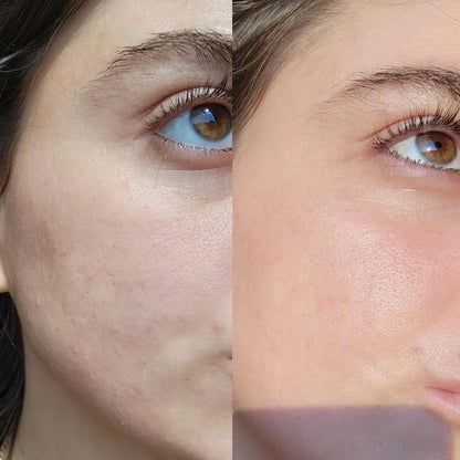 Eco By Sonya Serum of Clear 30ml